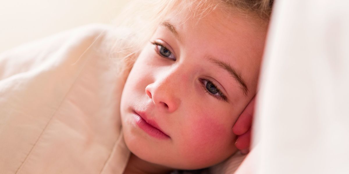 Scarlet Fever: Symptoms, Causes, and Prevention Measures