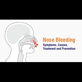 Nosebleed in Children: Causes, Symptoms, Treatment Tips and When to See a Doctor